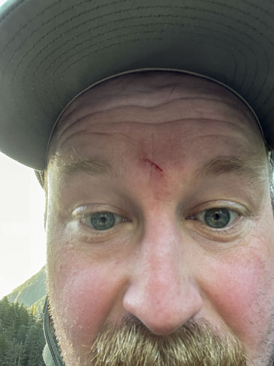 The author bears the mark of scope bite.