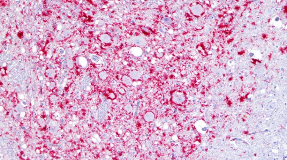 First Case of CWD Detected at Louisiana/Mississippi Border | An ...